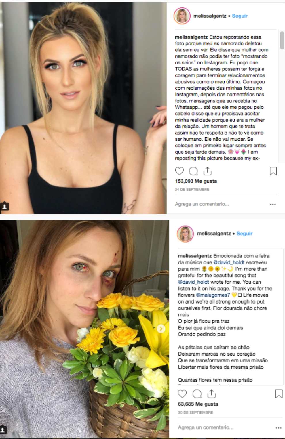 Instagram de la modelo agredida.