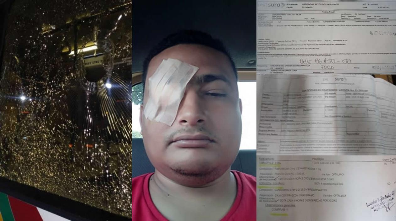 José Eduardo Collazo Mejía, el usuario que sufrió lesiones en su ojo derecho tras  el ataque a un busetón de Transmetro