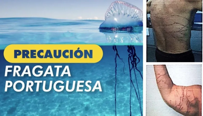 Autoridades recomiendan precaución por la medusa fragata en las playas de Santa Marta.