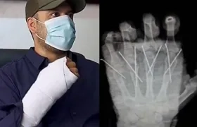Al policía lograron reimplantarle la mano amputada. 