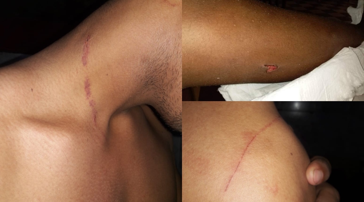 Las lesiones que recibieron los jóvenes tras la agresión de los policías.