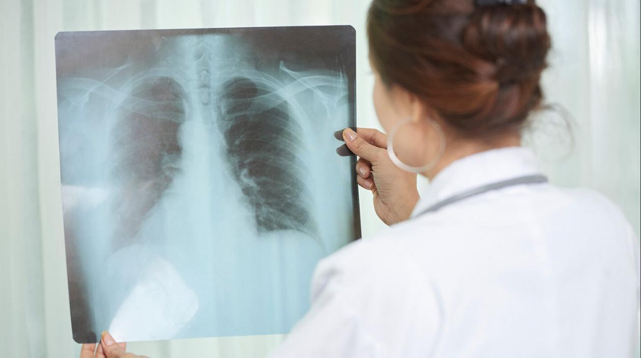 Colombia es el quinto país de la región con mayor carga de casos de tuberculosis.