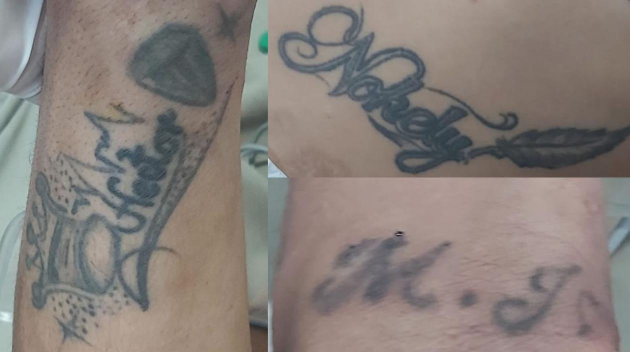Estos son los tatuajes que tiene el paciente que está internado en la Clínica Campbell. 