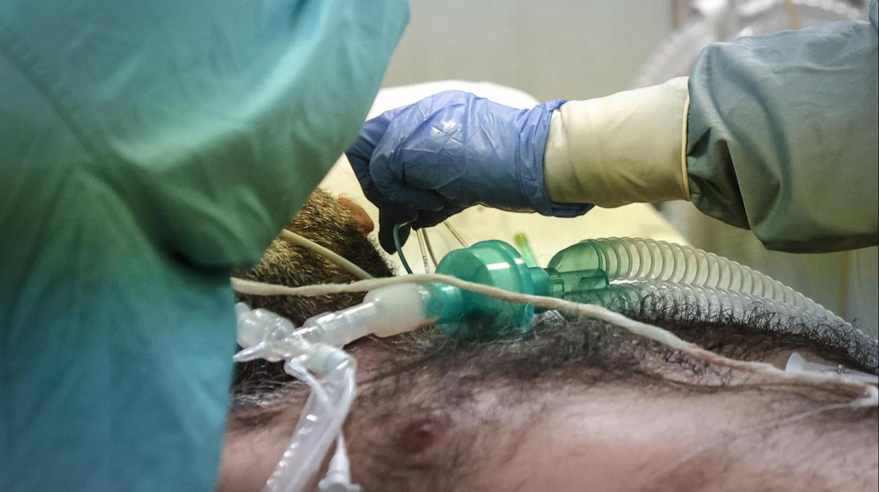 En la imagen de archivo, un paciente es tratado en la Unidad de Cuidados Intensivos del Policlínico di Tor Vergata en Roma, Italia