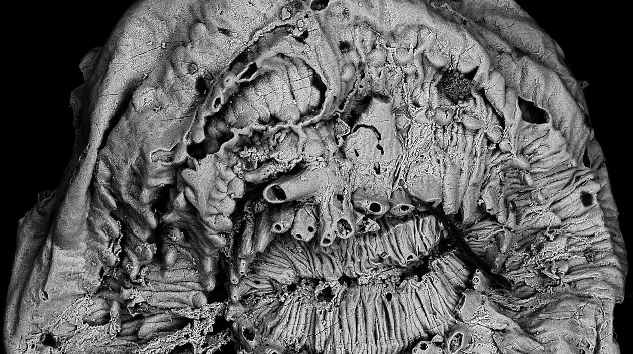 Imagen de un Saccorhytus a través de un microscopio electrónico de barrido. 