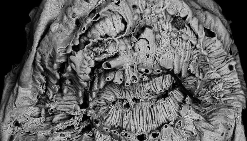 Imagen de un Saccorhytus a través de un microscopio electrónico de barrido. 