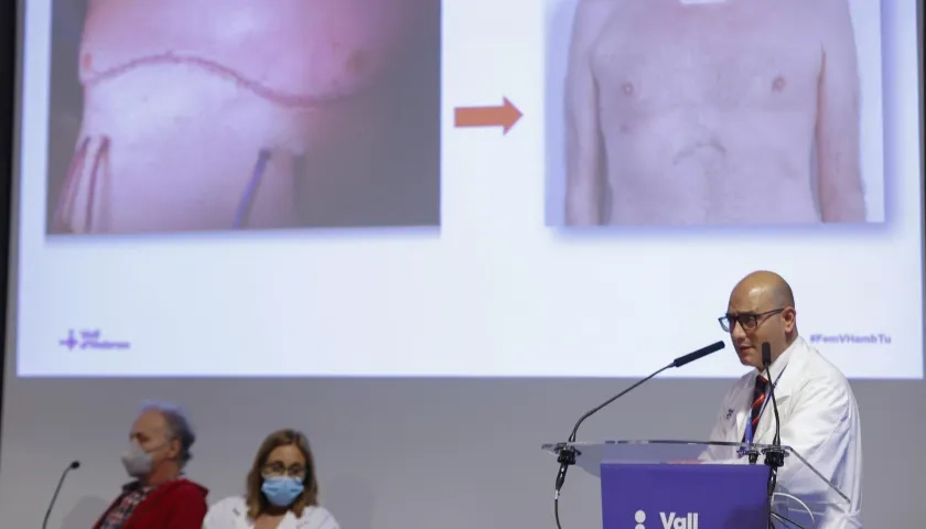 Todo un éxito el primer transplante pulmonar robótico 