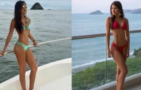 La Señorita Magdalena María Camila Cárdenas Rapelo, antes y después de las cirugías.