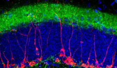 Tinción de marcadores neuronales estudiados en el del hipocampo de un ratón macho adulto. 
